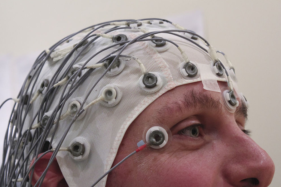 epilepsie - EEG