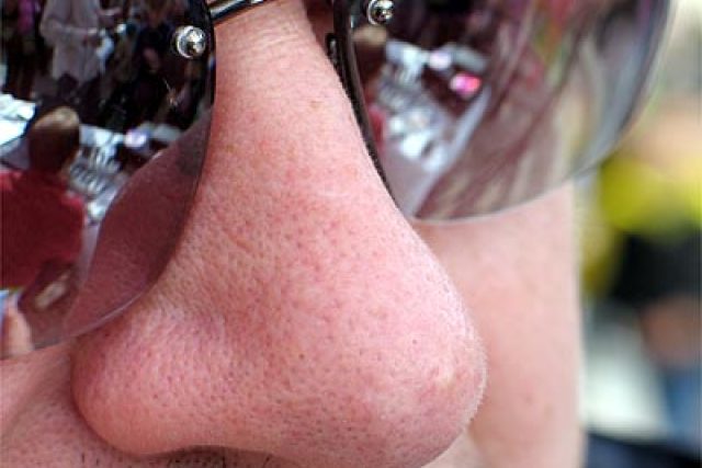 nos a brýle | foto: Jan Rosenauer