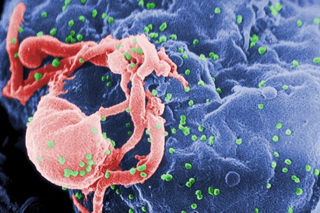 HIV-1 na kultuře lymfocytů | foto: CDC/ C. Goldsmith,  P. Feorino,  E. L. Palmer,  W. R. McM