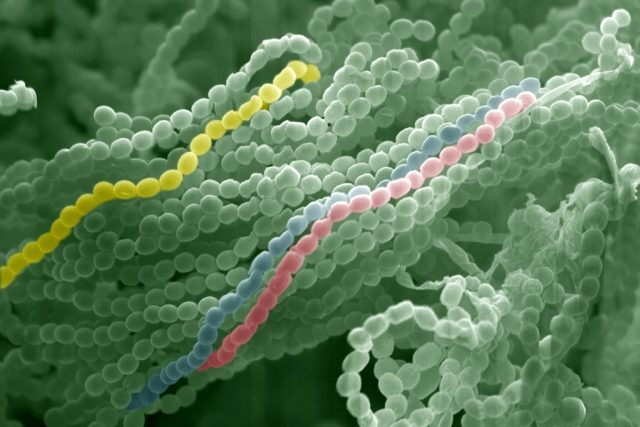 Plíseň štětičkovec Penicillium chrysogenum pod elektronovým mikroskopem | foto:  Lehrstuhl Allgemeine und Molekulare Botanik