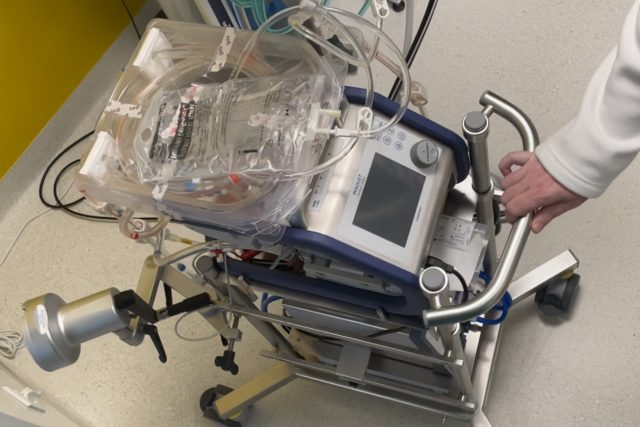 „Je to systém hadic,  oxygenátoru a pumpy,  který bere od pacienta krev. Ta je nasávána centrifugální pumpou a proháněna filtrem z dutých vláken,  kde je z ní odstraněn CO2 a přidán kyslík.“ | foto: Ondřej Vaňura,  Český rozhlas