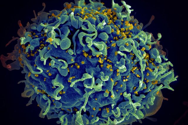 Buňka napadená virem HIV  (označen žlutě) | foto: Unsplash,  CC0 1.0