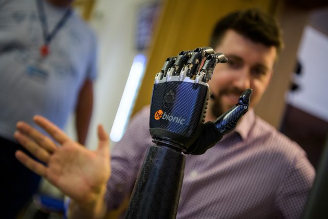 Bionická ruka dává pacientům zcela nové možnosti | foto: Khalil Baalbaki,  Český rozhlas