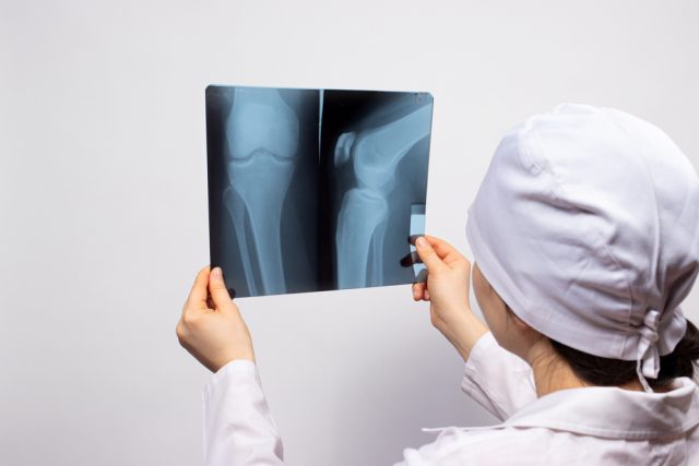 Koleno je anatomicky nejsložitější kloub v našem těle  (ilustrační foto) | foto: Shutterstock